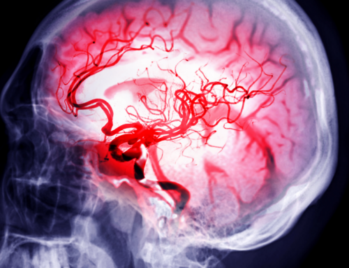 RAA is the First EMS Agency In Virginia to Implement New American Heart Association Stroke Training